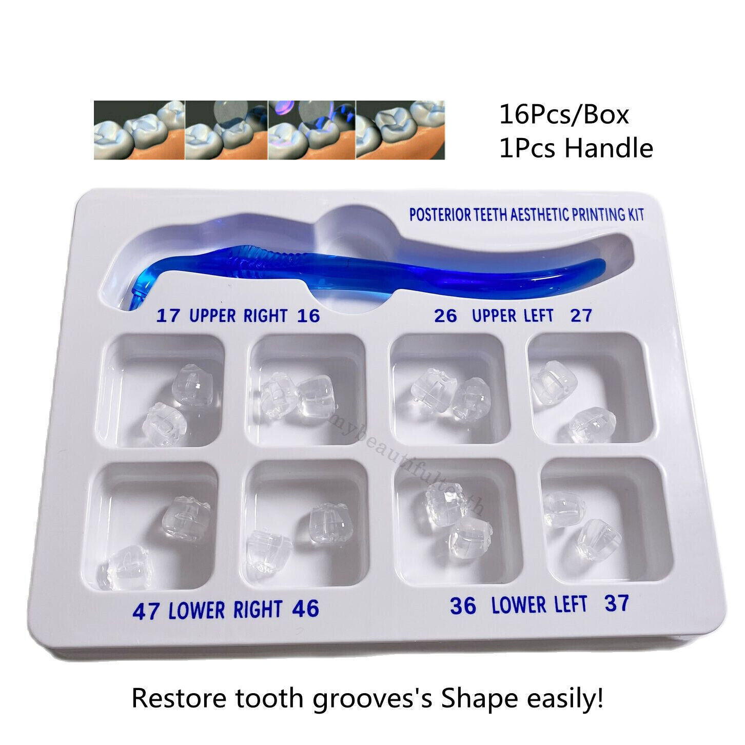 1Kit Dental Restoration Filling Tools Dental Posterior Teeth Aesthetic Printing