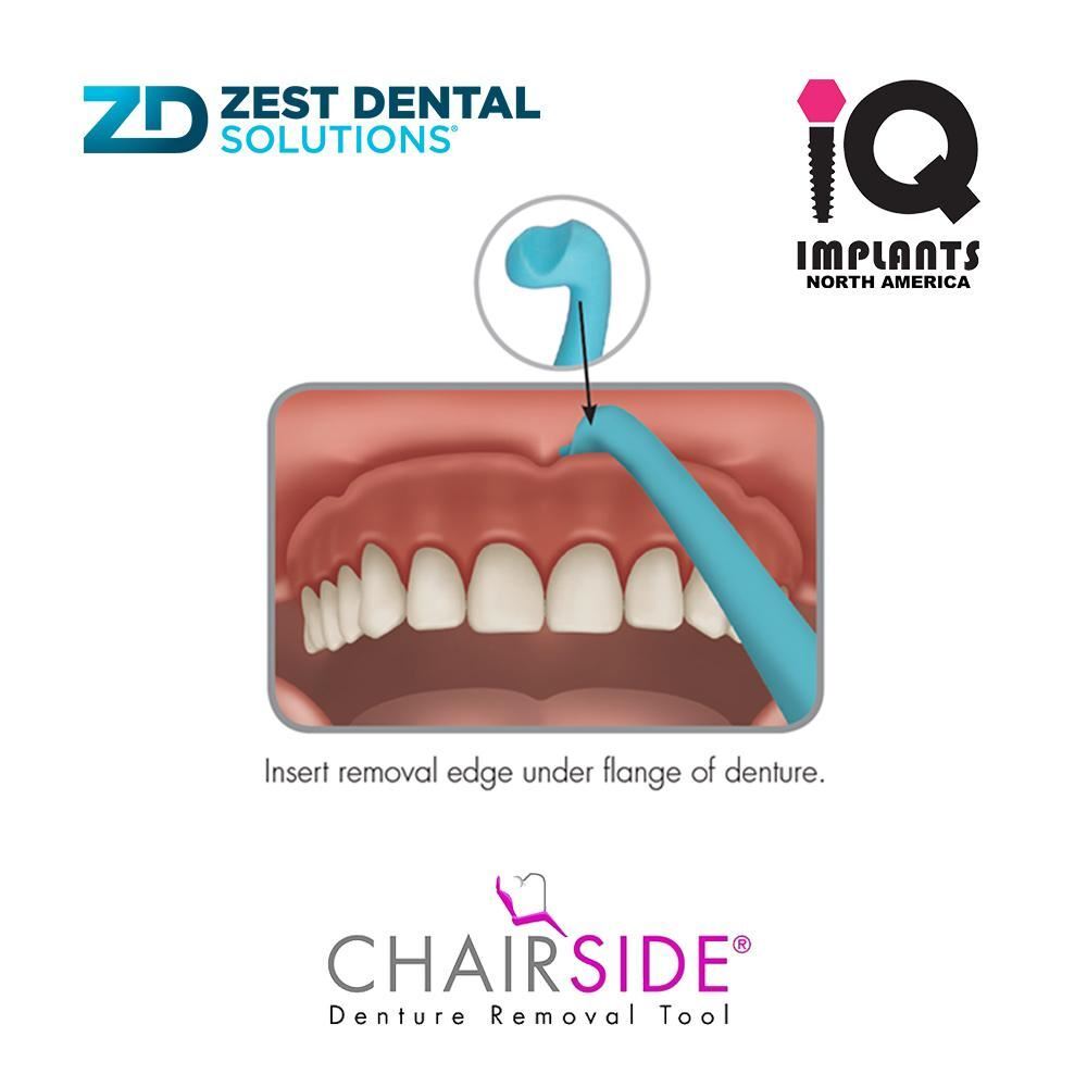 Zest CHAIRSIDE Genuine Dental Removal Tool for Artificial Teeth, 2-Pack