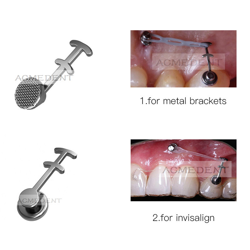 10Pcs Dental Lingual Buttons Double-Sided Hooks Crimpable Multi Hook Brackets