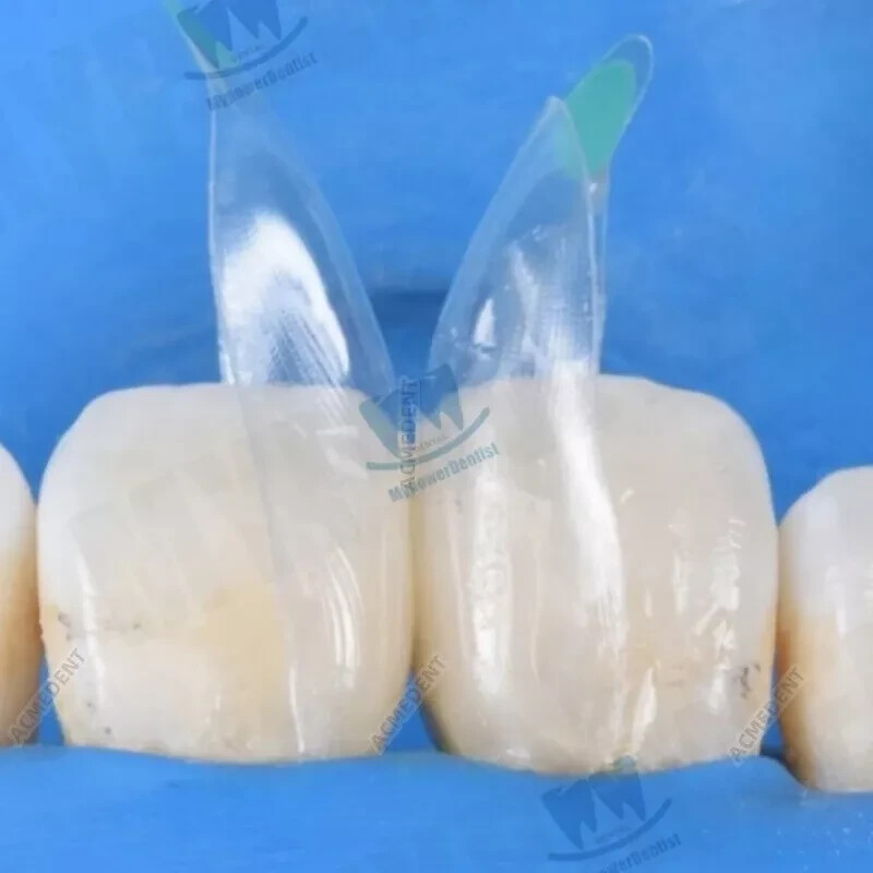 Clear Matrix Dental Diastema Matrices Wedge Similar with Bio Clear Matrice TORVM
