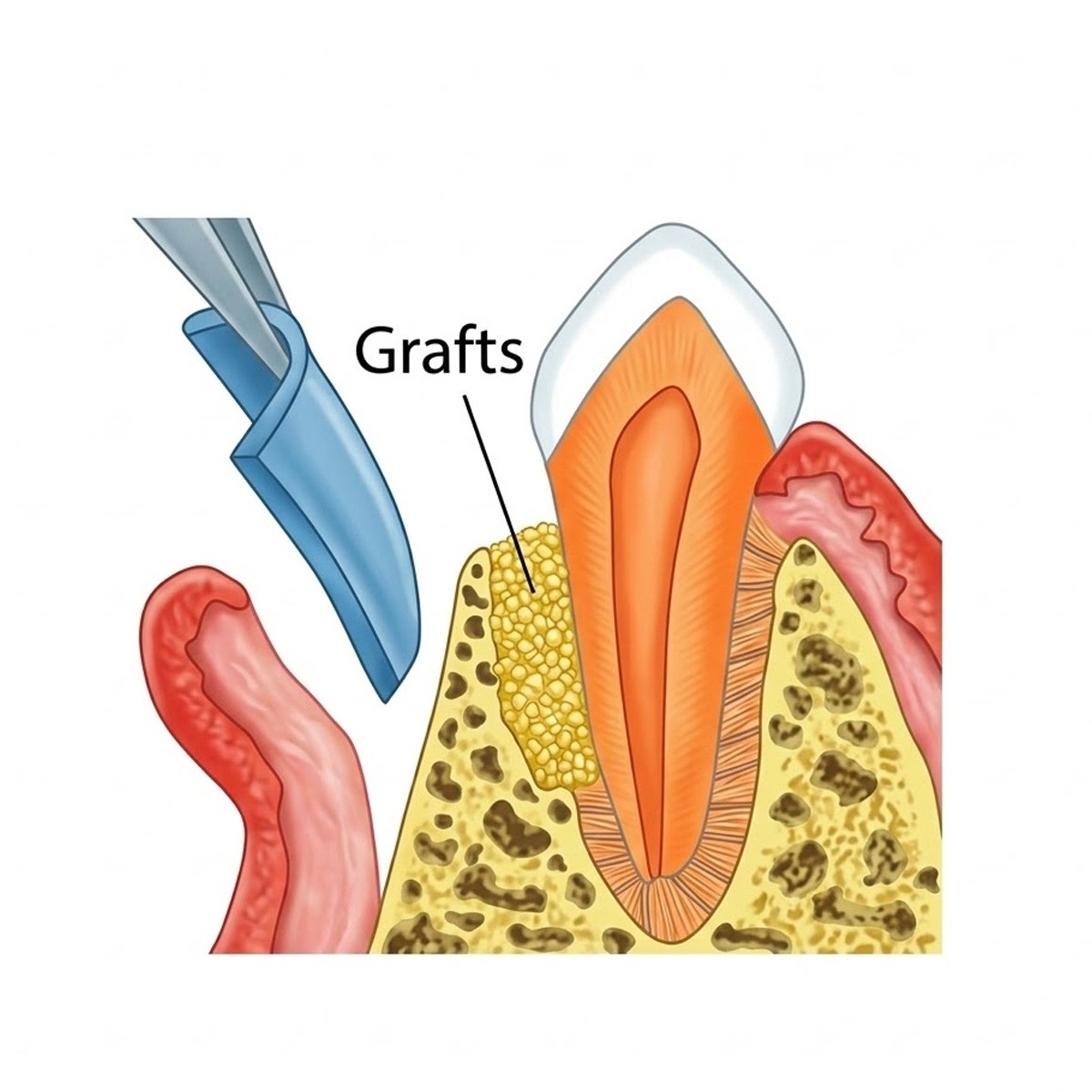 Cologenesis ColoGide GTR Membrane – Pack Of 1