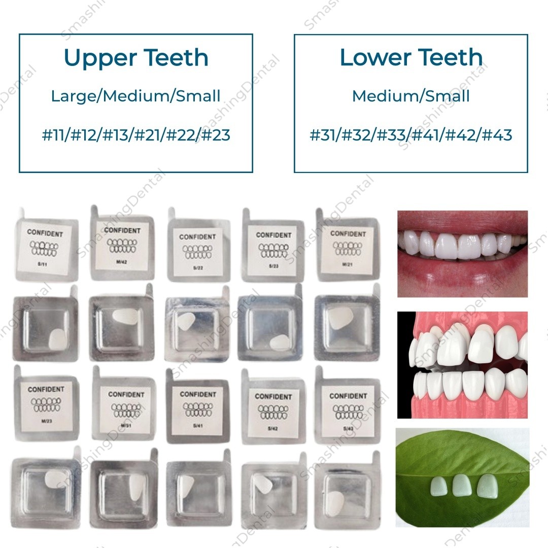 30Pcs Dental Composite Porcelain Veneers Resin Light Cure Anterior Teeth Veneer