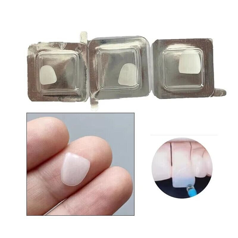 30 Pcs Dental Porcelain Light Cure Anterior Teeth Veneers Porcelain Resin Tool