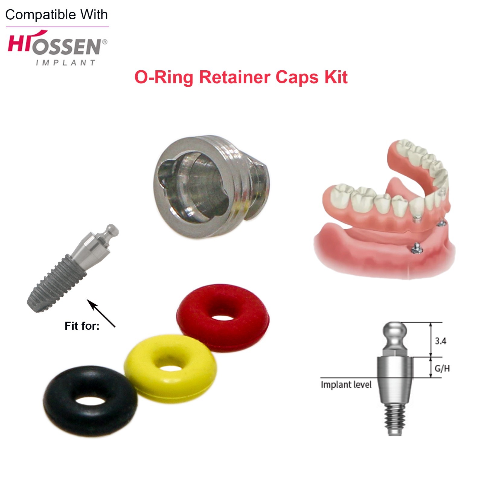 4Pcs/Set Dental Implant O-ring Retainer Caps Kit Ball Abutment forHiossen Osstem