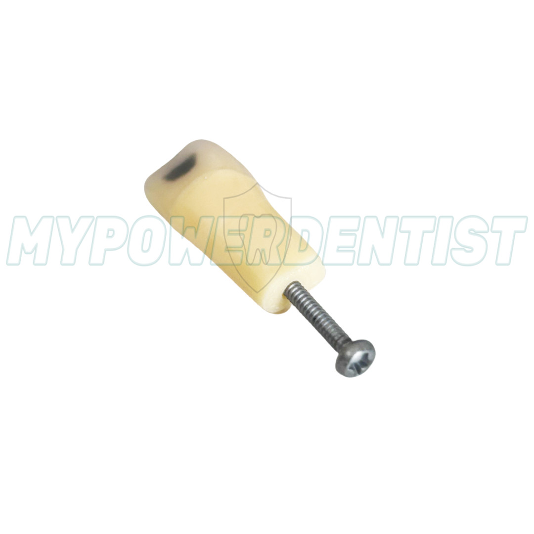 25# Dental Cavity Teeth Model Tooth Teaching Caries ModelCompatible Frasaco AG-3
