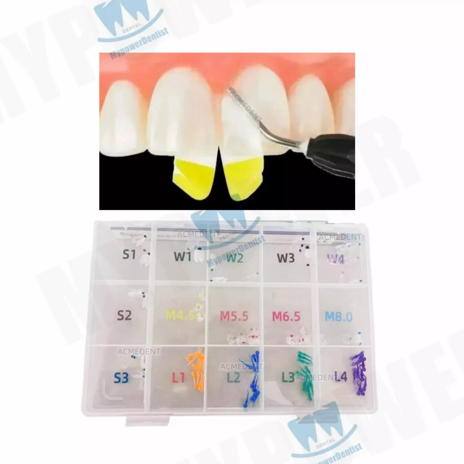 Clear Matrix Dental Diastema Matrices Wedge Similar with Bio Clear Matrice TORVM