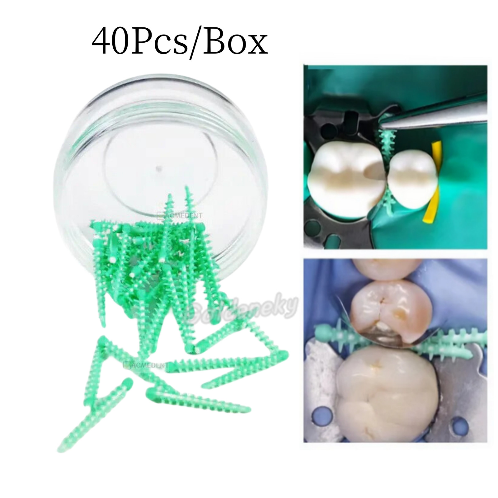 40Pc/box Dental Adaptive Silicone Interdental Wedge Dental Matrice Matrix Wedges