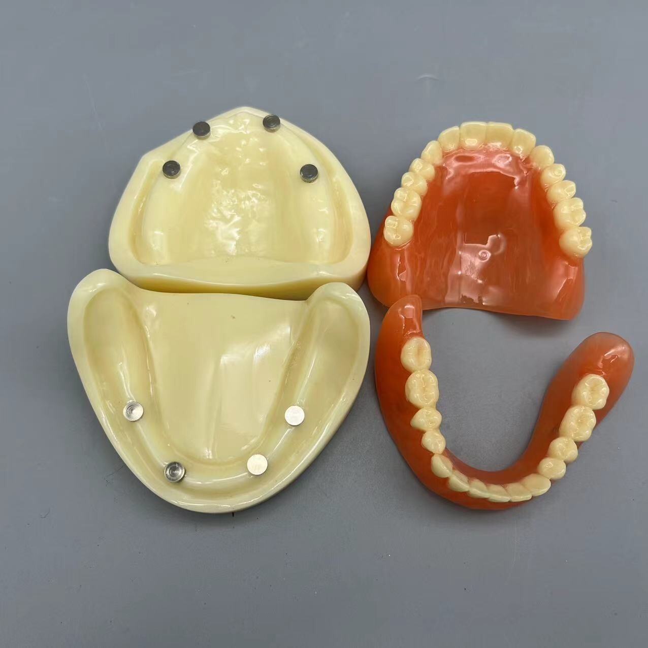 Dental 4 Implants Overdenture Typodont Restoration Upper Lower Lower Teeth Model