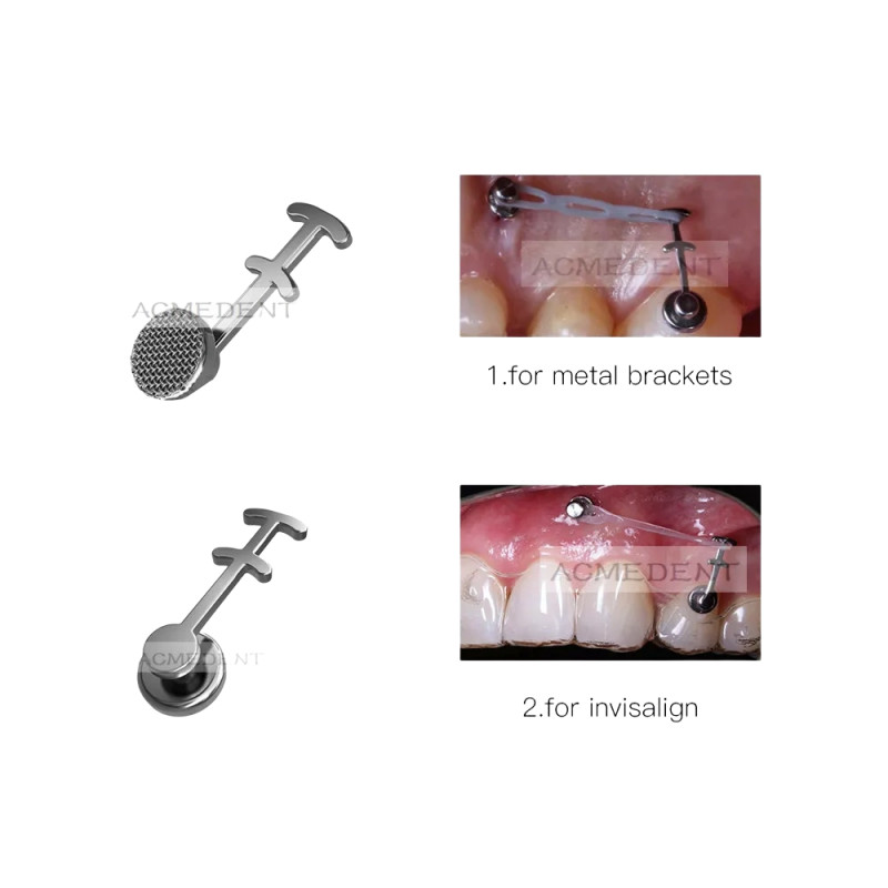 Dental Lingual Buttons Double-Sided Hooks Crimpable Multi Hook Brackets